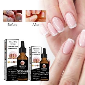 EELHOE Nail Repair Liquid Thickening, Brightening, Whitening, Repairing, Moisturizing, And Nourishing Nail Care Liquid (Nail care liquid: 1pcs)